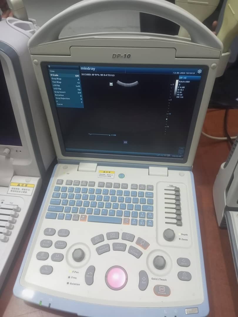 Mindray DP-10 portable ultrasound machine